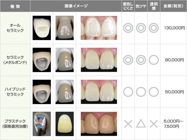 前歯のかぶせ物