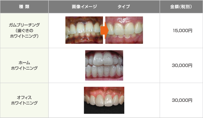 保険治療と保険外治療（自費治療）